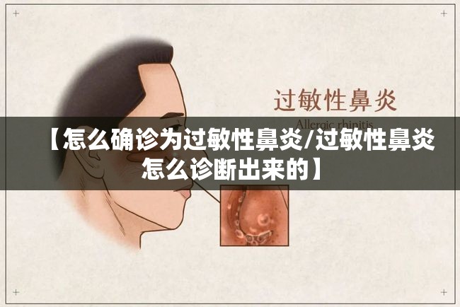 【怎么确诊为过敏性鼻炎/过敏性鼻炎怎么诊断出来的】