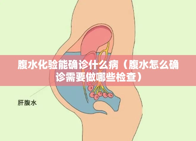 腹水化验能确诊什么病(腹水怎么确诊需要做哪些检查) 腹水化验能确诊什么病(腹水怎么确诊需要做哪些检查)