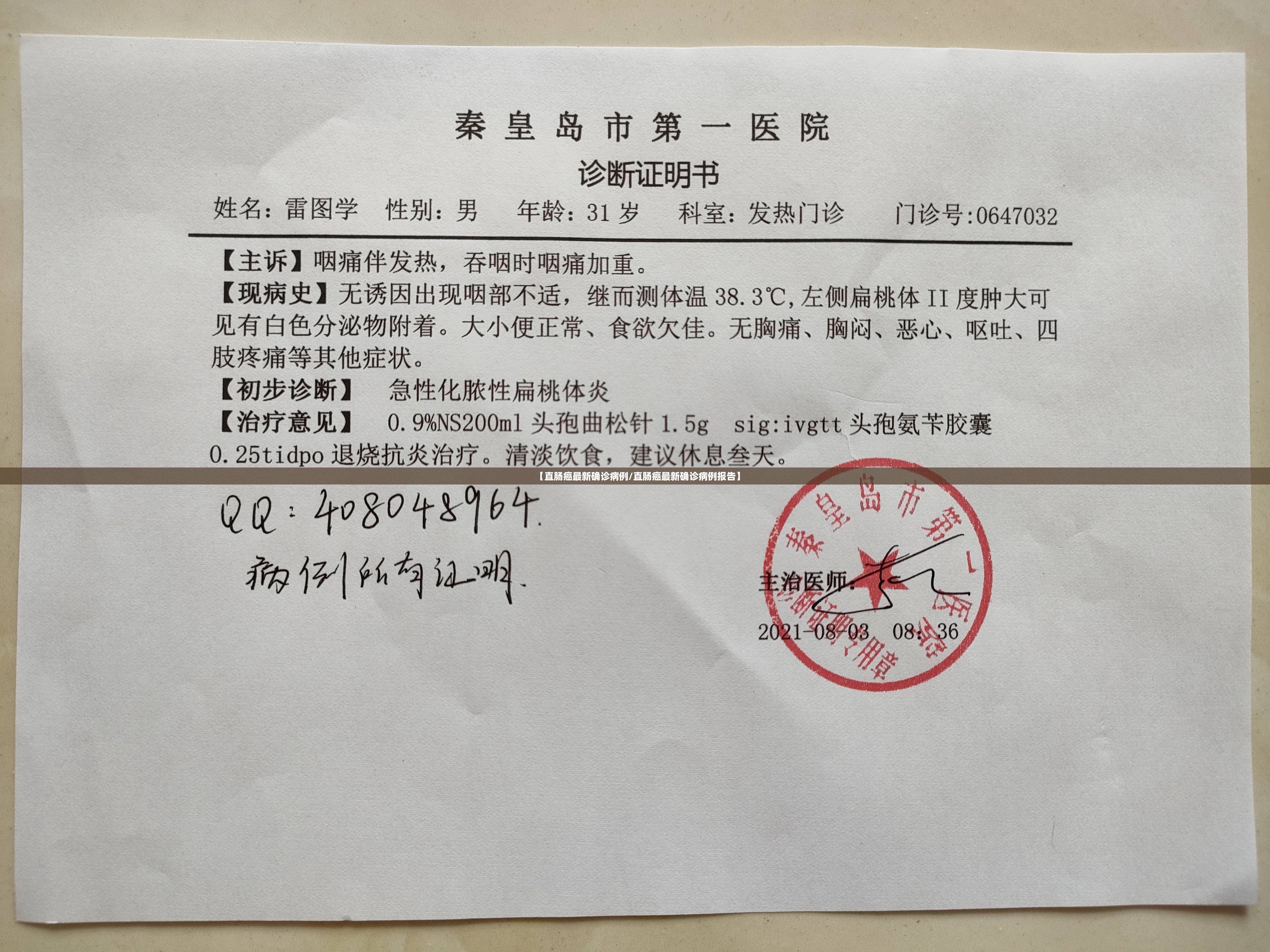 【直肠癌最新确诊病例/直肠癌最新确诊病例报告】 【直肠癌最新确诊病例/直肠癌最新确诊病例报告】