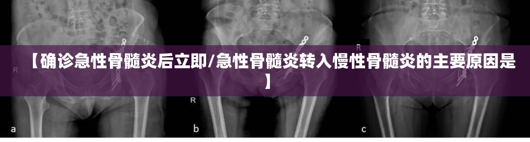 【确诊急性骨髓炎后立即/急性骨髓炎转入慢性骨髓炎的主要原因是】 【确诊急性骨髓炎后立即/急性骨髓炎转入慢性骨髓炎的主要原因是】