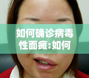 如何确诊病毒性面瘫:如何确诊病毒性面瘫呢
