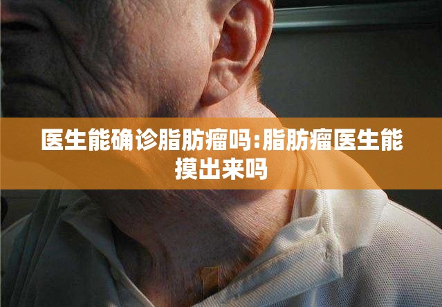 医生能确诊脂肪瘤吗:脂肪瘤医生能摸出来吗