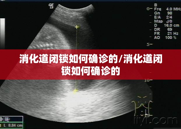 消化道闭锁如何确诊的/消化道闭锁如何确诊的 消化道闭锁如何确诊的/消化道闭锁如何确诊的