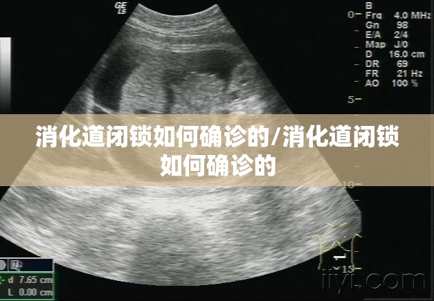 消化道闭锁如何确诊的/消化道闭锁如何确诊的 消化道闭锁如何确诊的/消化道闭锁如何确诊的