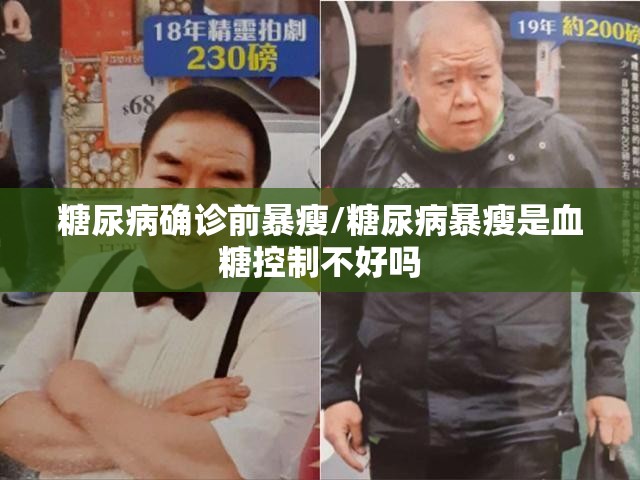 糖尿病确诊前暴瘦/糖尿病暴瘦是血糖控制不好吗 糖尿病确诊前暴瘦/糖尿病暴瘦是血糖控制不好吗