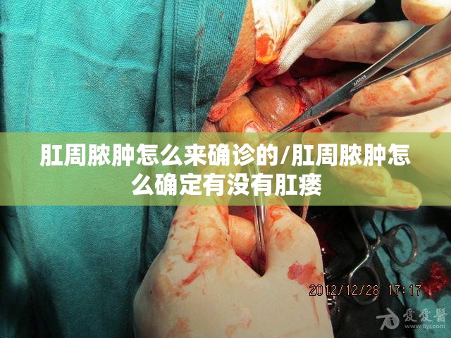 肛周脓肿怎么来确诊的/肛周脓肿怎么确定有没有肛瘘 肛周脓肿怎么来确诊的/肛周脓肿怎么确定有没有肛瘘