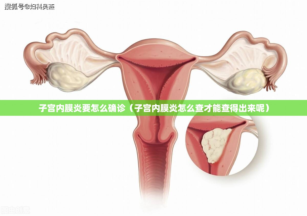 子宫内膜炎要怎么确诊(子宫内膜炎怎么查才能查得出来呢) 子宫内膜炎要怎么确诊(子宫内膜炎怎么查才能查得出来呢)