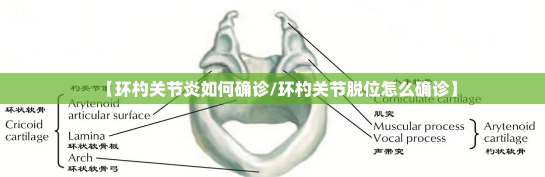 【环杓关节炎如何确诊/环杓关节脱位怎么确诊】 【环杓关节炎如何确诊/环杓关节脱位怎么确诊】