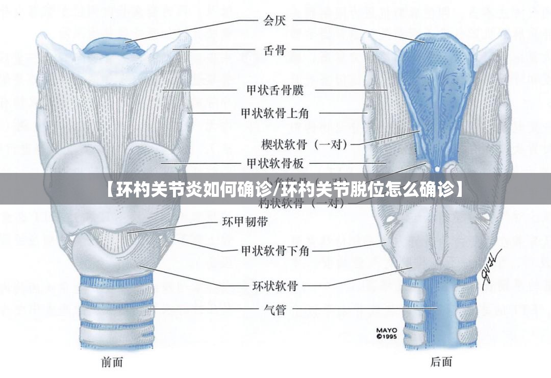 【环杓关节炎如何确诊/环杓关节脱位怎么确诊】 【环杓关节炎如何确诊/环杓关节脱位怎么确诊】